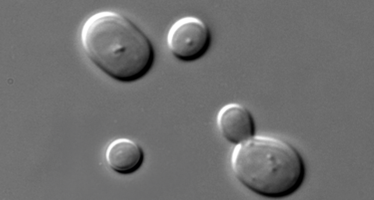 Microscopic image of Saccharomyces cerevisiae, a common yeast in cell culture contamination