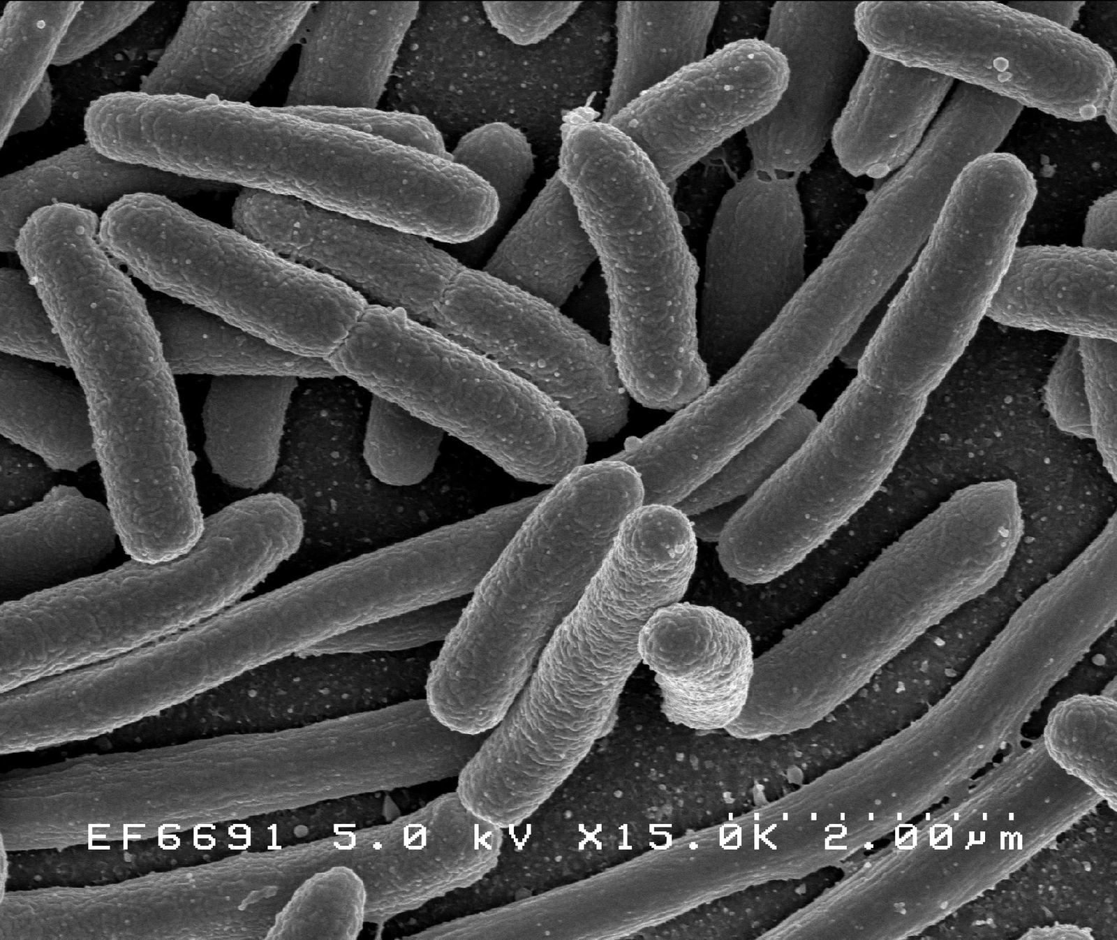 E. coli bacteria under microscope representing common cell culture contamination
